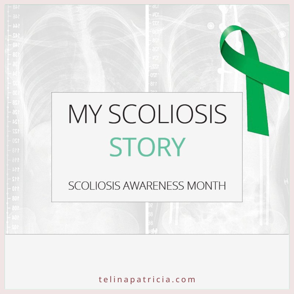 My Scoliosis Story | Scoliosis Awareness Month